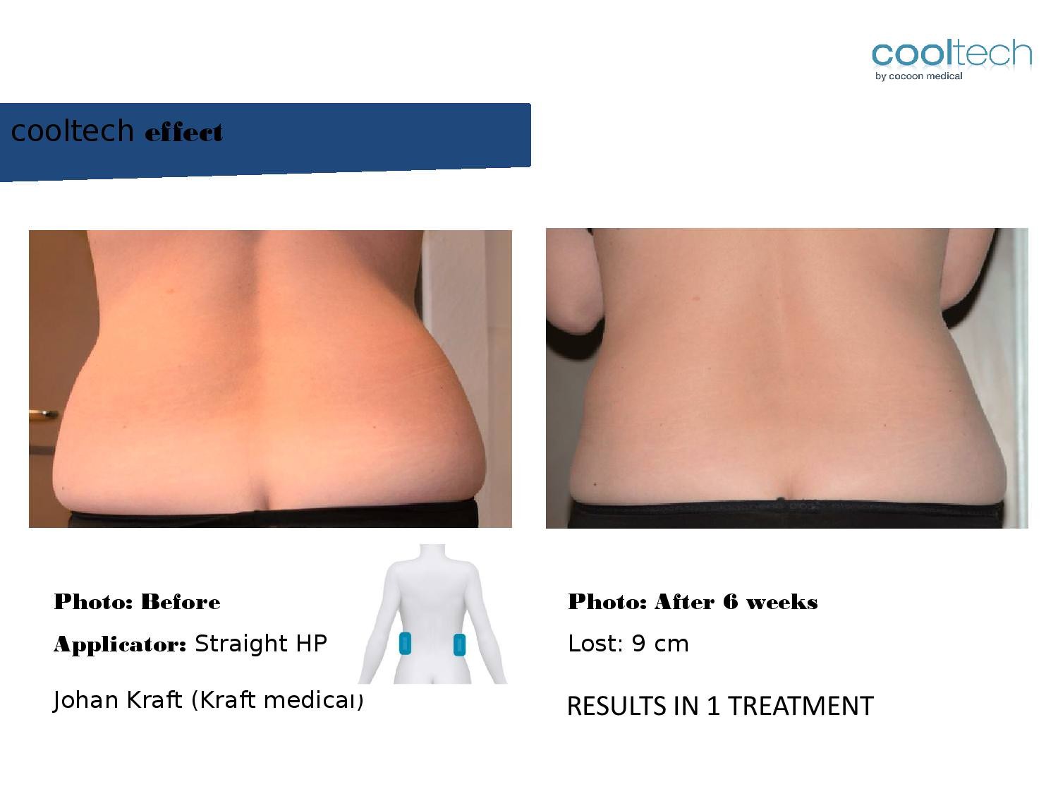 Presentation Cooltech ENG Wigmore Days Novaaaa1-page-010